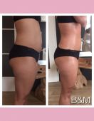 bioslimming-beautyenmore-2