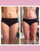 bioslimming-beautyenmore