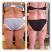 bioslimming-wrap-beautyenmore