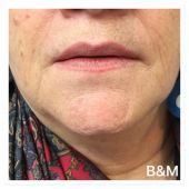 pmu-lippen-beautyenmore